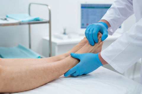 Как развивается хроническая венозная недостаточность