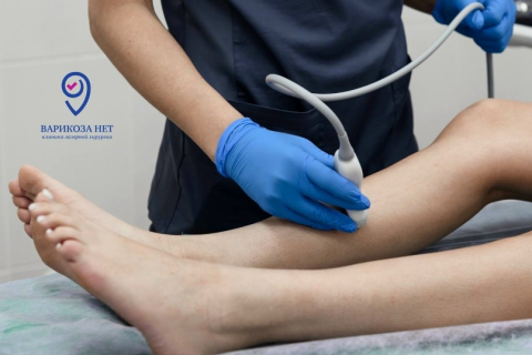 Как врач оценивает состояние вен при осмотре